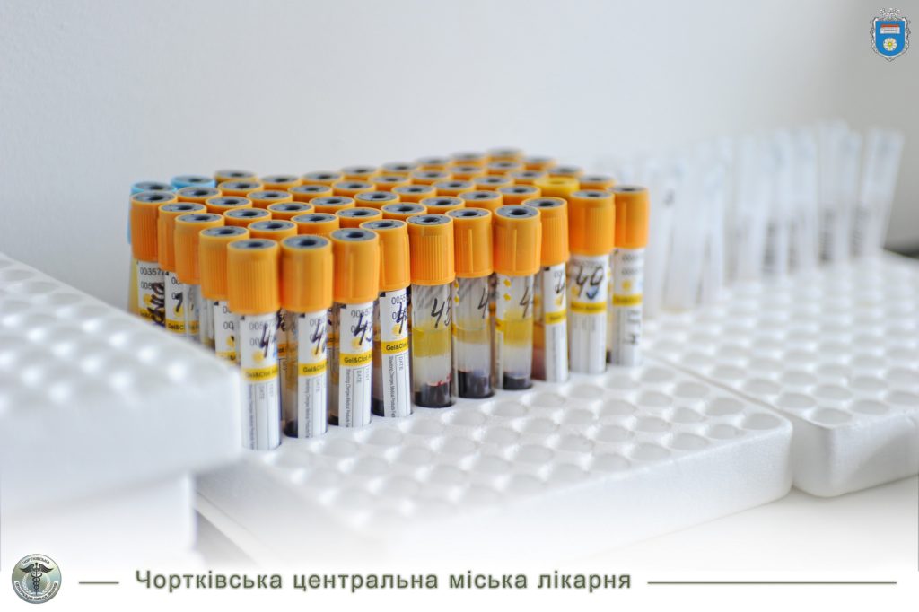 У ЛАБОРАТОРІЇ ЧОРТКІВСЬКОЇ МІСЬКОЇ ЛІКАРНІ ЗА ПЕРШІ ТРИ МІСЯЦІ РОКУ ЗРОБИТИ БІЛЬШЕ 40 ТИСЯЧ АНАЛІЗІВ